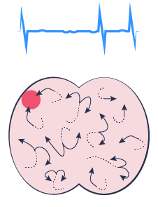 Migrating waves of re-entrant activation