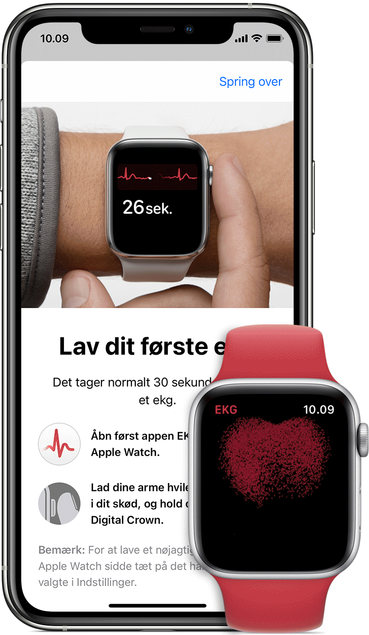 Apple watch ekg hjerterytme