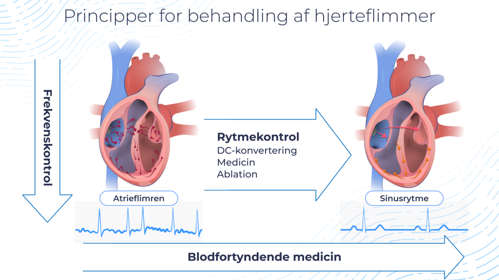 hjerteflimmer behandlingsprincipper